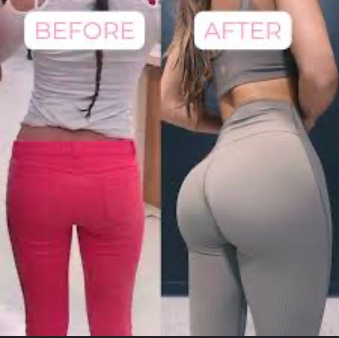 Rapid-Action BBL Syrup Butt Enlargement for Quick Growth – Lifting and Firming