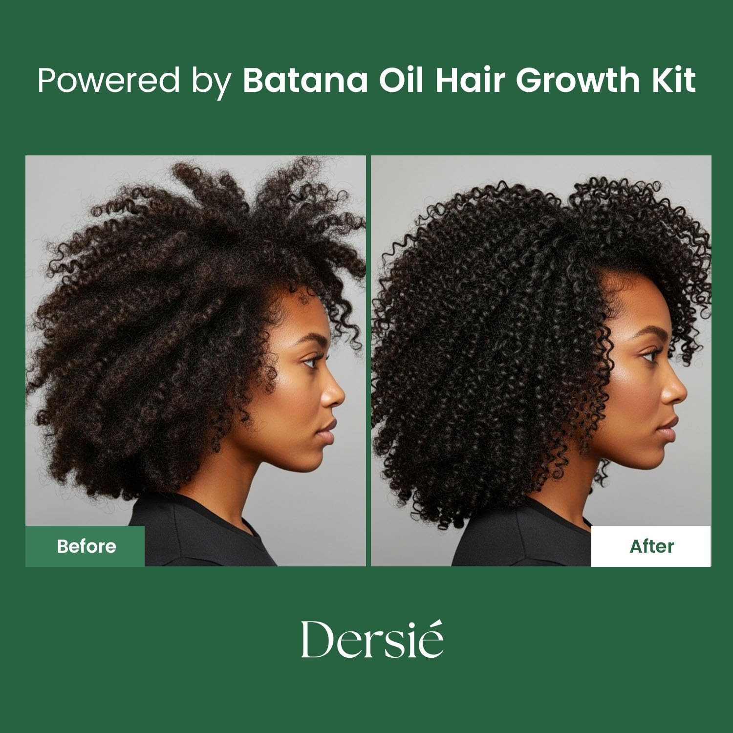 Dersie Batana Oil Hair Care Routine Set – Foundational Oil & Shampoo Steps